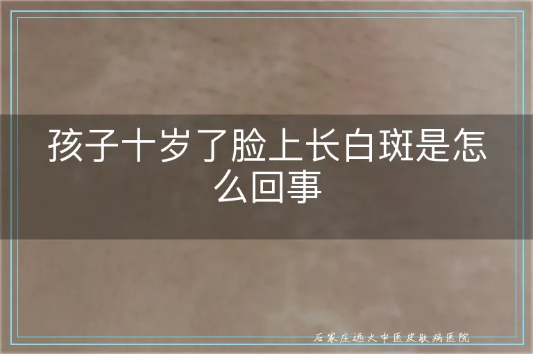 孩子十岁了脸上长白斑是怎么回事