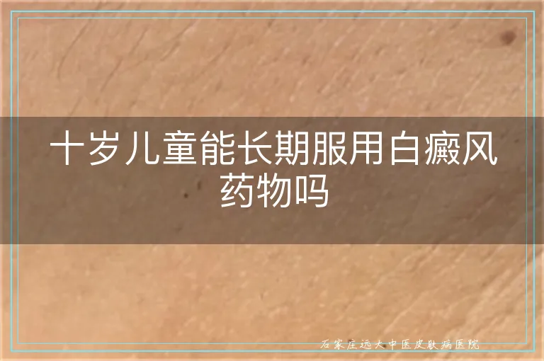十岁儿童能长期服用白癜风药物吗