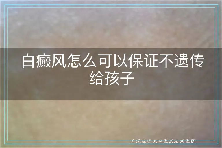 白癜风怎么可以保证不遗传给孩子
