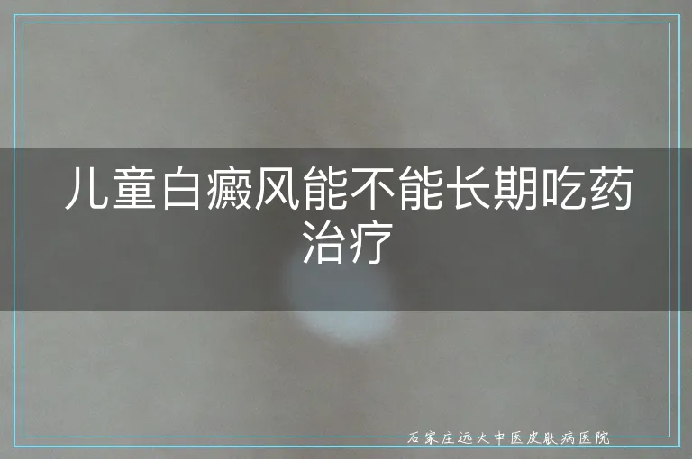儿童白癜风能不能长期吃药治疗