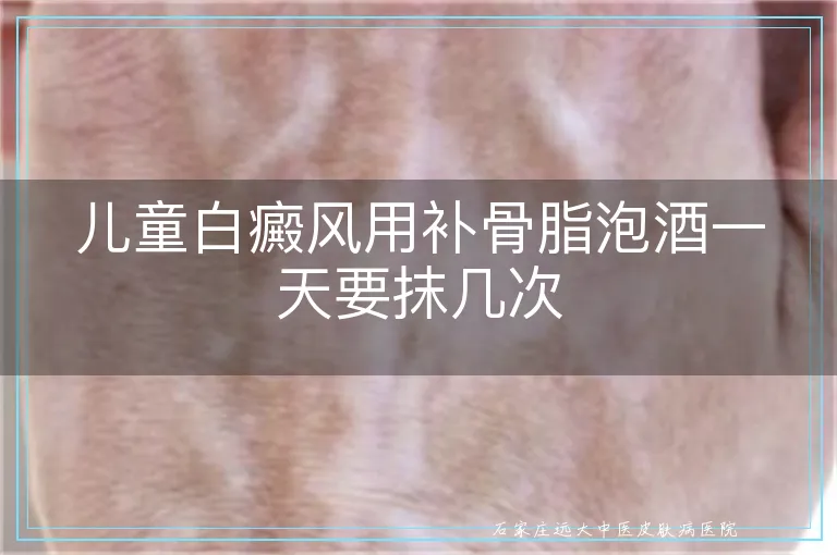 儿童白癜风用补骨脂泡酒一天要抹几次