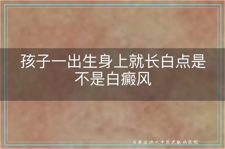 孩子一出生身上就长白点是不是白癜风
