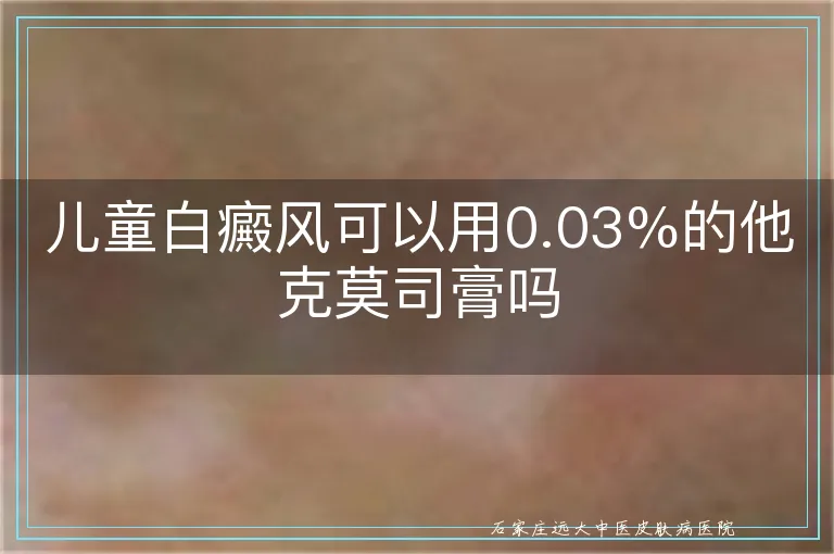 儿童白癜风可以用0.03%的他克莫司膏吗