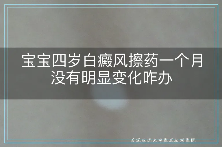 宝宝四岁白癜风擦药一个月没有明显变化咋办