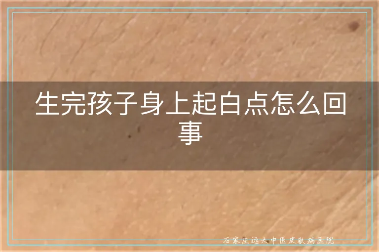 生完孩子身上起白点怎么回事