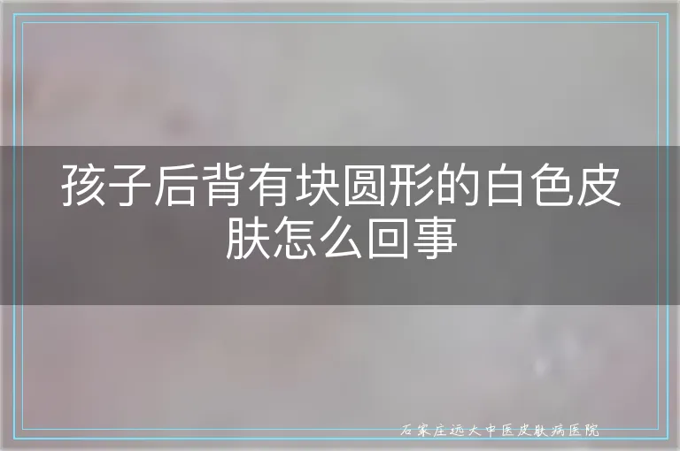 孩子后背有块圆形的白色皮肤怎么回事