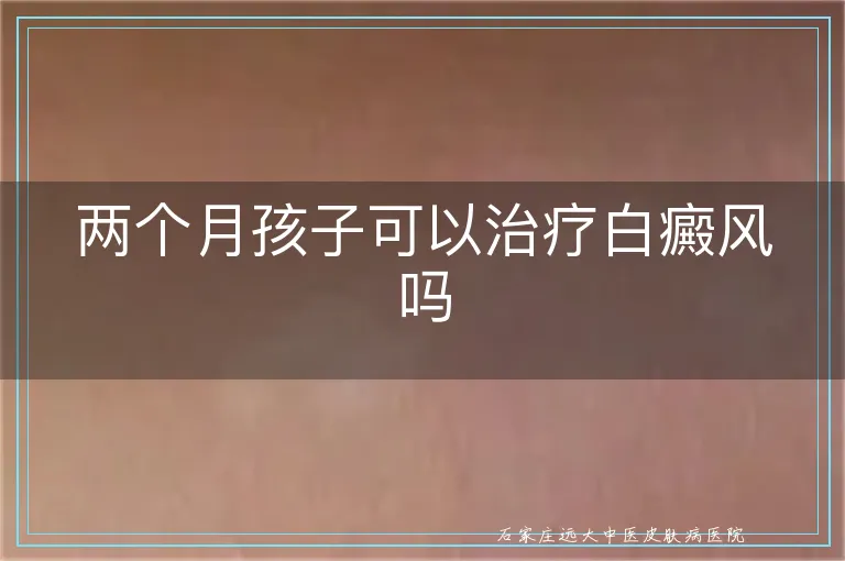 两个月孩子可以治疗白癜风吗