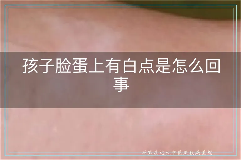 孩子脸蛋上有白点是怎么回事