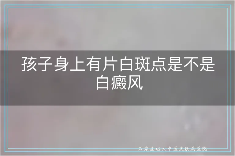 孩子身上有片白斑点是不是白癜风