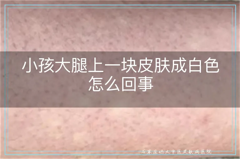 小孩大腿上一块皮肤成白色怎么回事