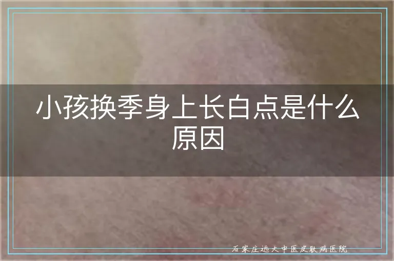 小孩换季身上长白点是什么原因
