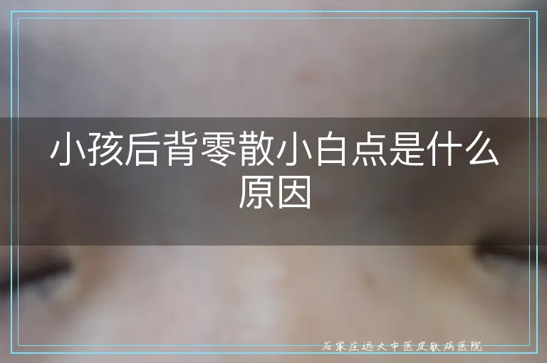 小孩后背零散小白点是什么原因