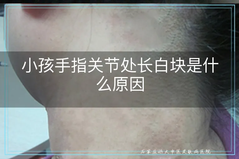 小孩手指关节处长白块是什么原因