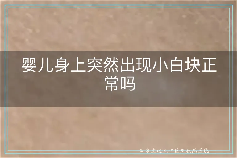 婴儿身上突然出现小白块正常吗