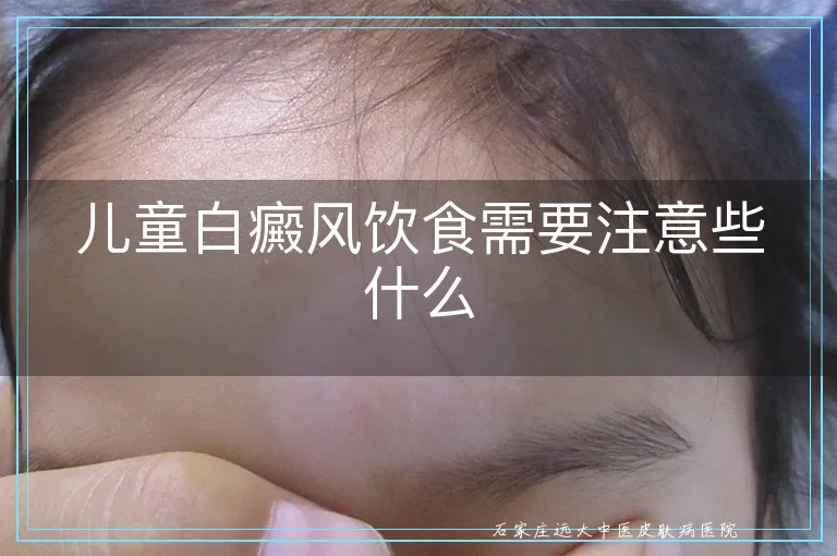 儿童白癜风饮食需要注意些什么