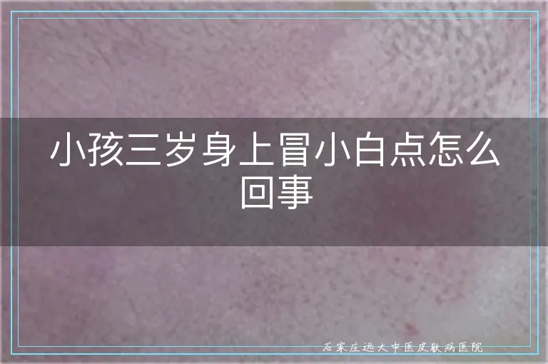 小孩三岁身上冒小白点怎么回事