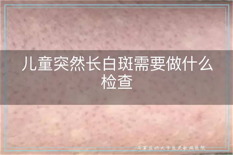 儿童突然长白斑需要做什么检查
