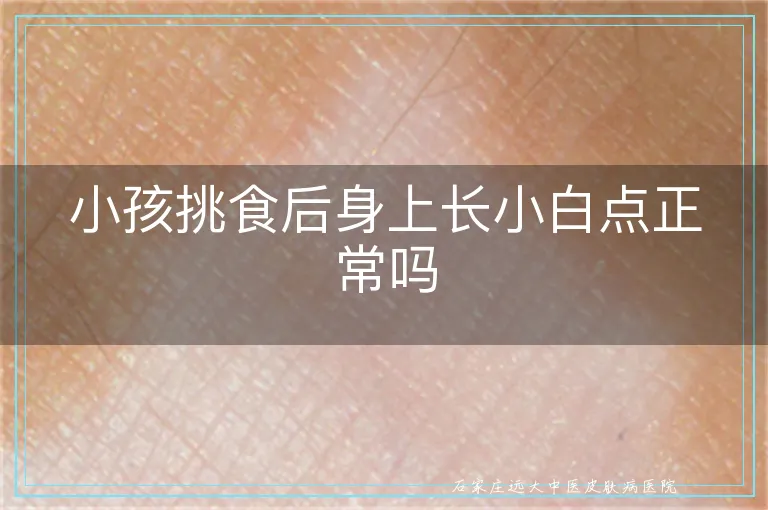 小孩挑食后身上长小白点正常吗