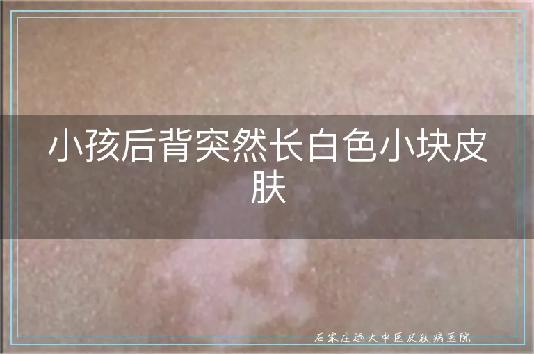 小孩后背突然长白色小块皮肤
