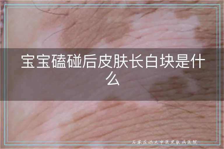 宝宝磕碰后皮肤长白块是什么