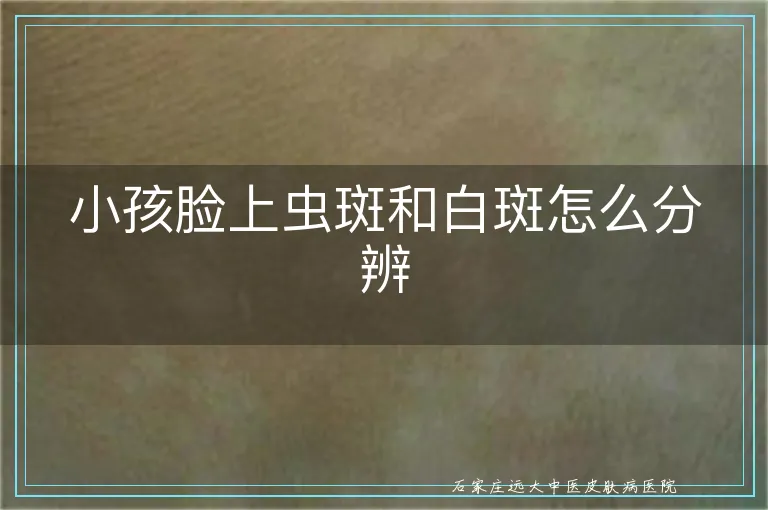 小孩脸上虫斑和白斑怎么分辨