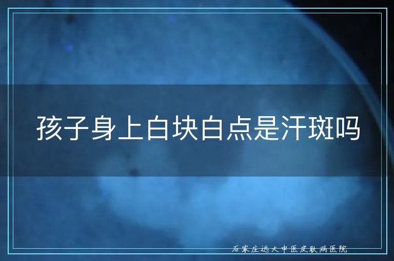 孩子身上白块白点是汗斑吗