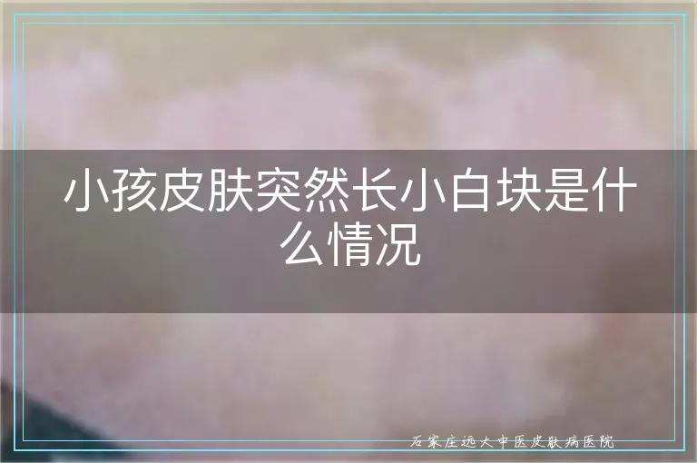 小孩皮肤突然长小白块是什么情况