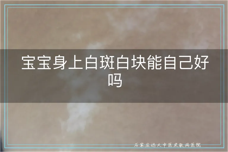 宝宝身上白斑白块能自己好吗