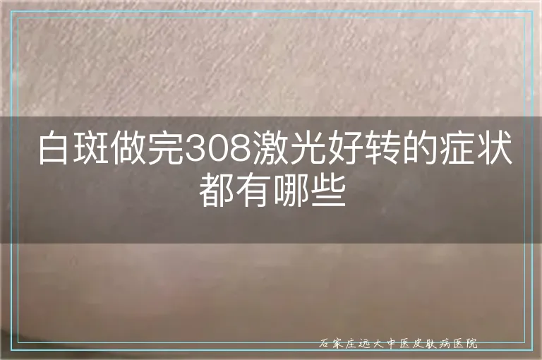 白斑做完308激光好转的症状都有哪些