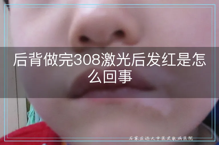 后背做完308激光后发红是怎么回事