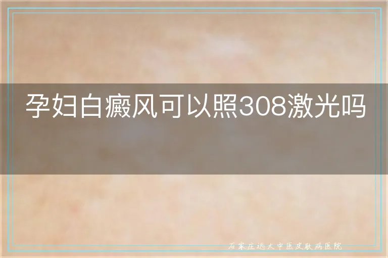 孕妇白癜风可以照308激光吗