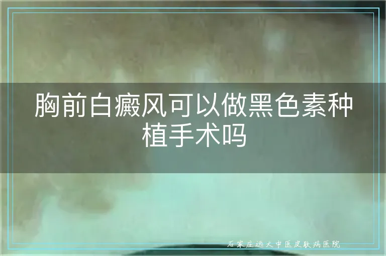 胸前白癜风可以做黑色素种植手术吗