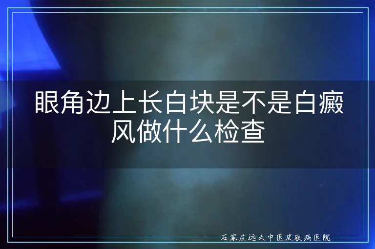 眼角边上长白块是不是白癜风做什么检查