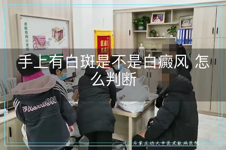 手上有白斑是不是白癜风 怎么判断