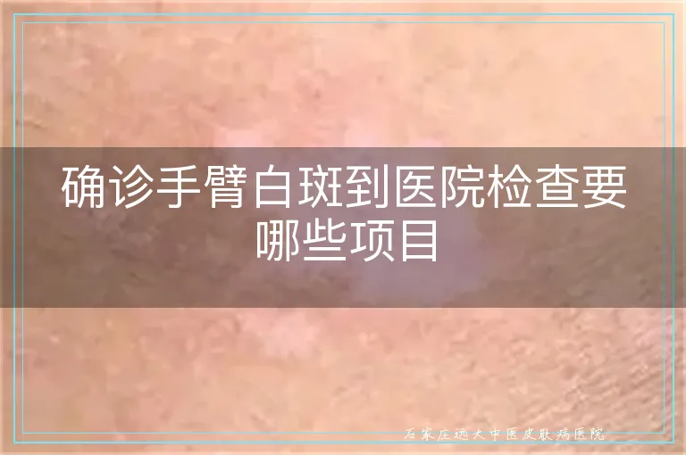 确诊手臂白斑到医院检查要哪些项目