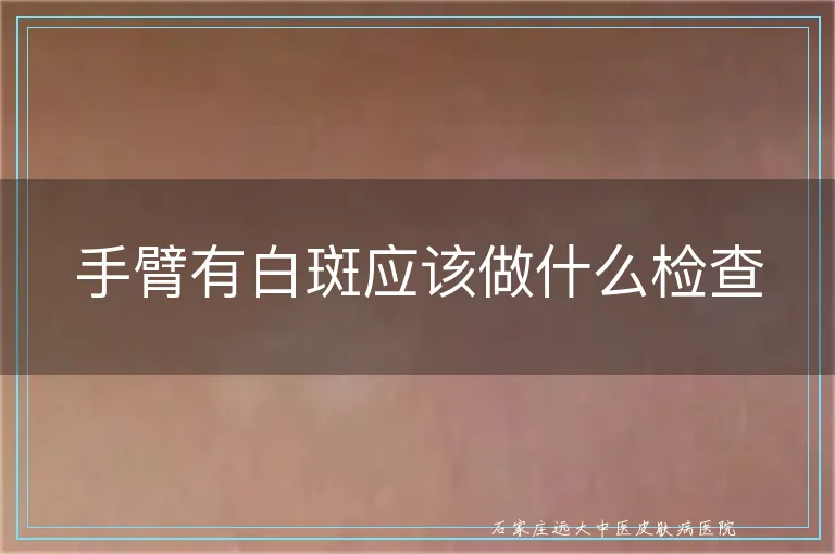 手臂有白斑应该做什么检查