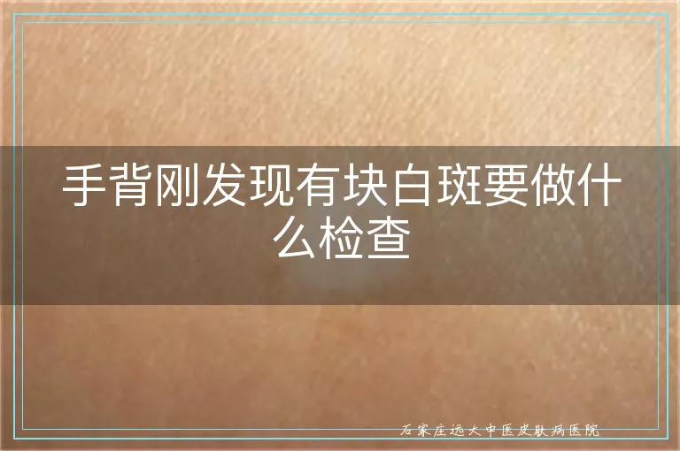手背刚发现有块白斑要做什么检查