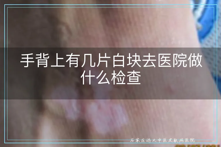 手背上有几片白块去医院做什么检查