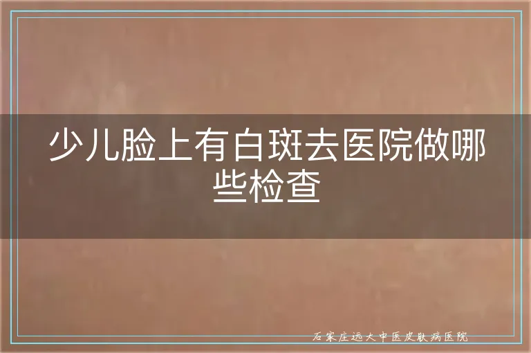 少儿脸上有白斑去医院做哪些检查