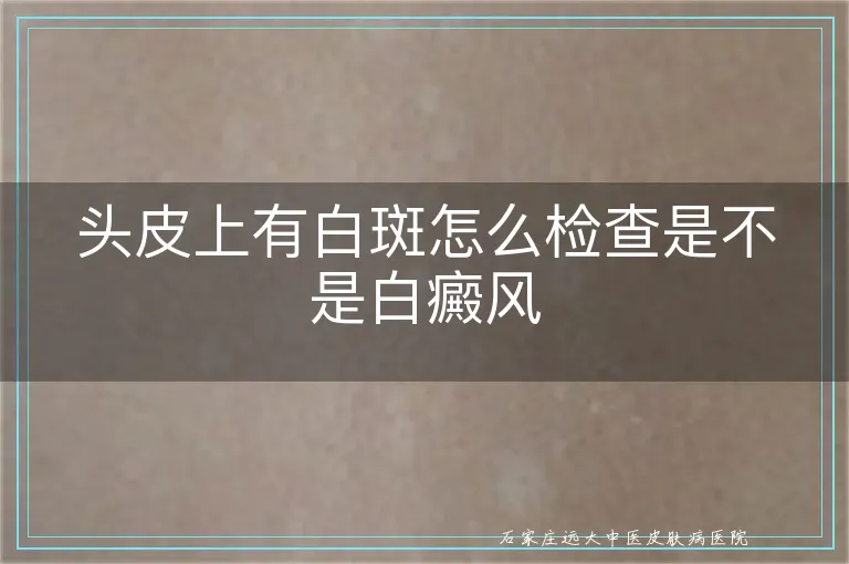 头皮上有白斑怎么检查是不是白癜风