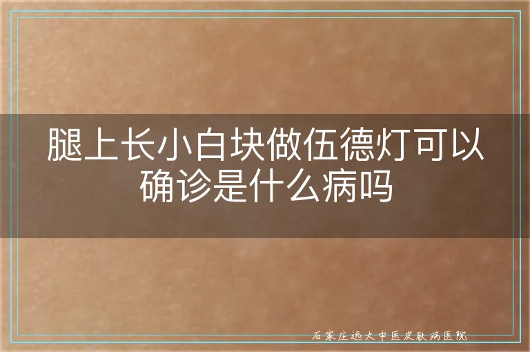 腿上长小白块做伍德灯可以确诊是什么病吗