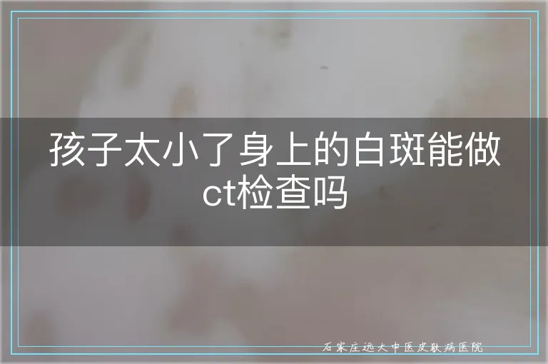 孩子太小了身上的白斑能做ct检查吗