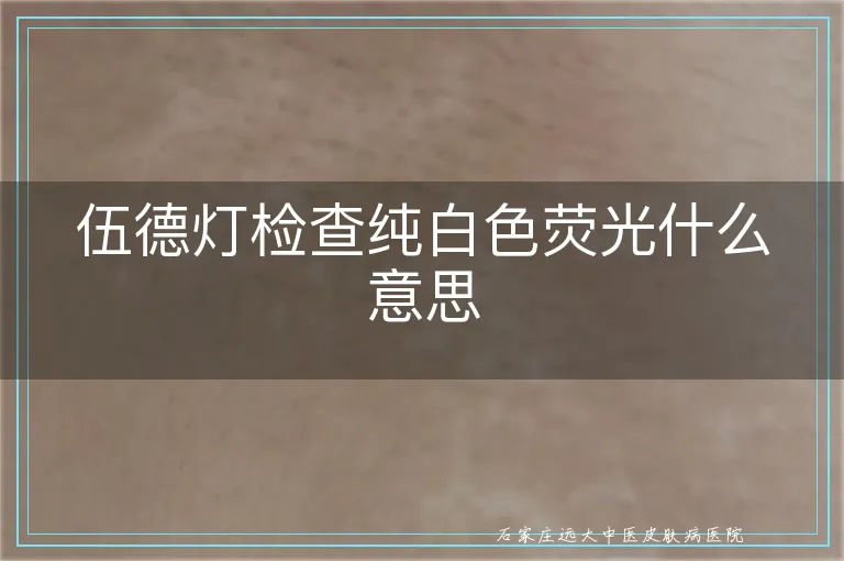 伍德灯检查纯白色荧光什么意思