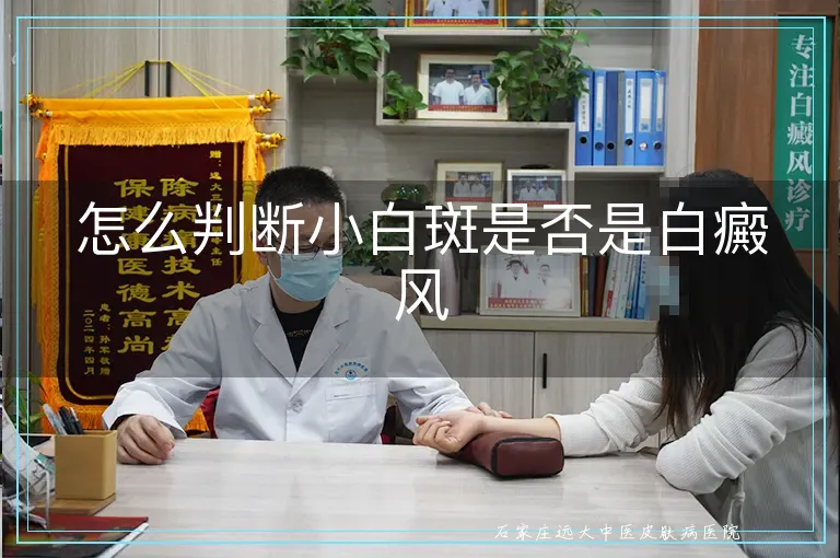 怎么判断小白斑是否是白癜风