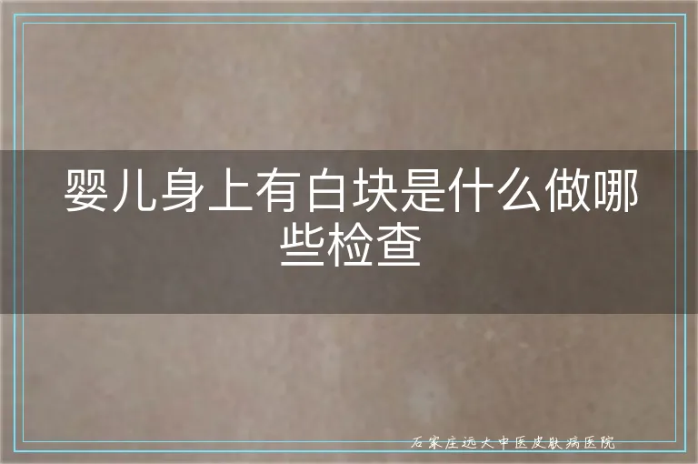 婴儿身上有白块是什么做哪些检查