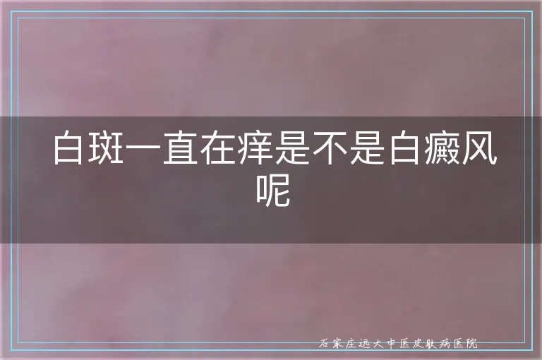 白斑一直在痒是不是白癜风呢