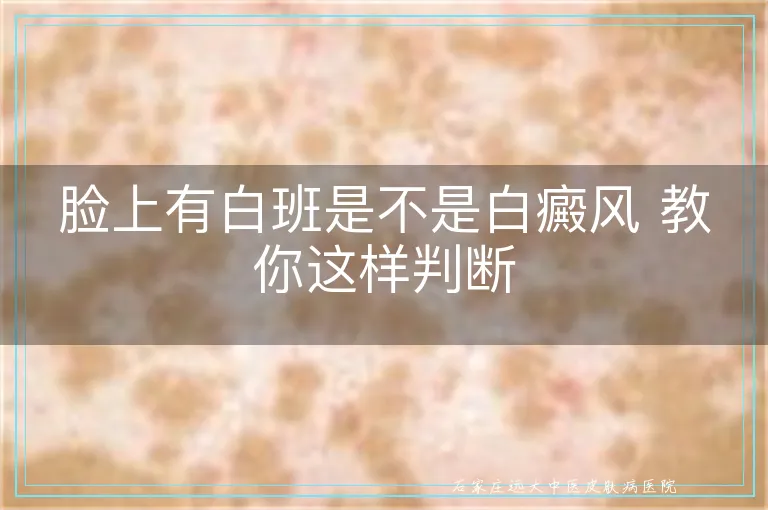 脸上有白班是不是白癜风 教你这样判断