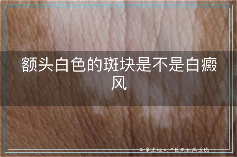 额头白色的斑块是不是白癜风