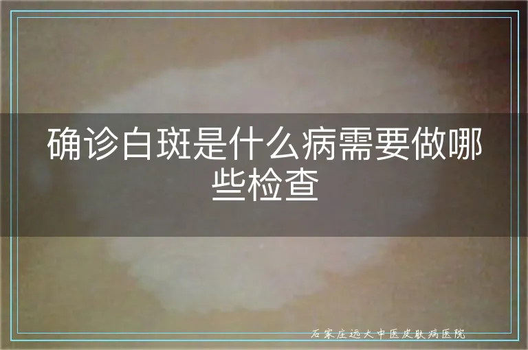 确诊白斑是什么病需要做哪些检查