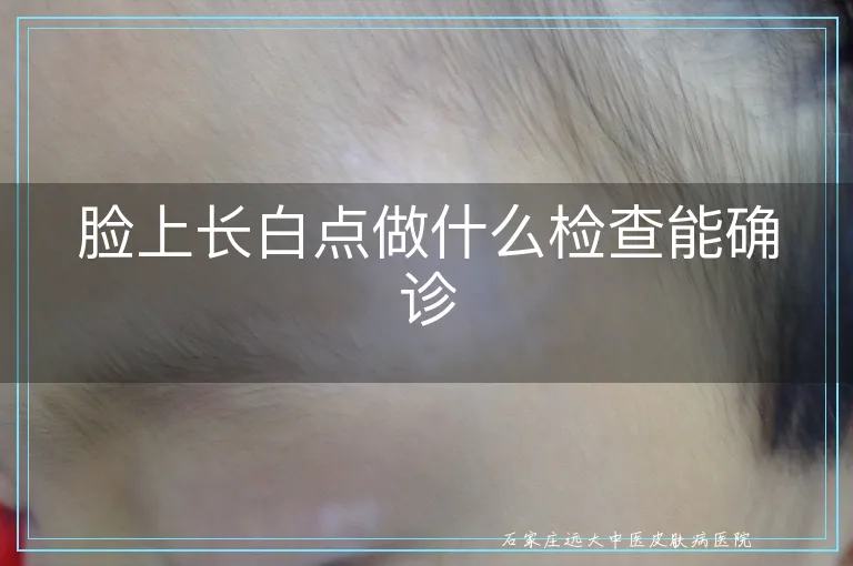 脸上长白点做什么检查能确诊